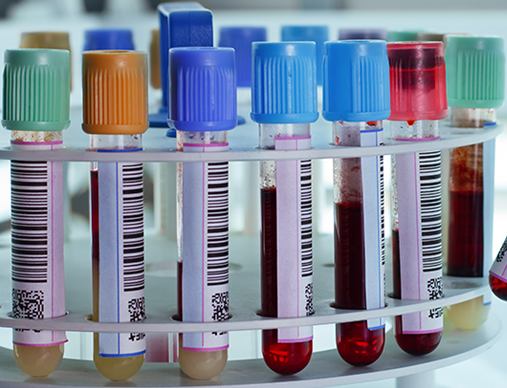 體外診斷IVD.png 體外診斷IVD.png